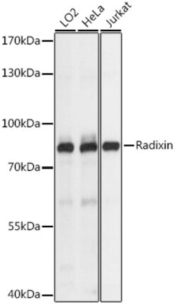 ABclonal Technology&nbsp;Radixin Rabbit pAb