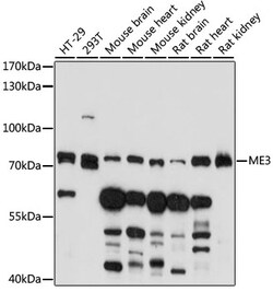 ABclonal Technology&nbsp;ME3 Rabbit pAb