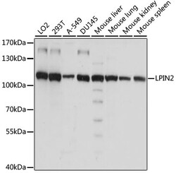 ABclonal Technology&nbsp;LPIN2 Rabbit pAb