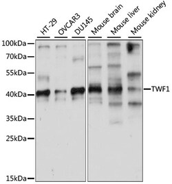 ABclonal Technology&nbsp;TWF1 Rabbit pAb
