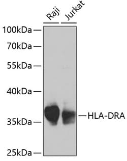 ABclonal Technology&nbsp;HLA-DRA Rabbit pAb