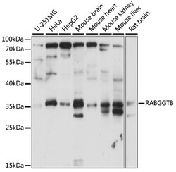 ABclonal Technology&nbsp;RABGGTB Rabbit pAb