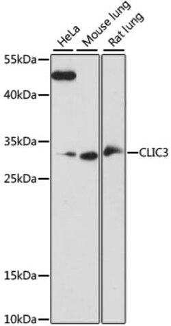 ABclonal Technology&nbsp;CLIC3 Rabbit pAb