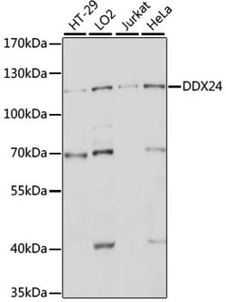 ABclonal Technology&nbsp;DDX24 Rabbit pAb