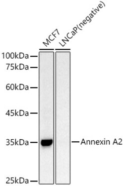 ABclonal Technology&nbsp;Annexin A2 Rabbit pAb