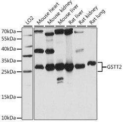 ABclonal Technology&nbsp;GSTT2 Rabbit pAb
