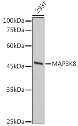 ABclonal Technology&nbsp;MAP3K8 Rabbit pAb