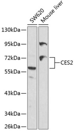 ABclonal Technology&nbsp;CES2 Rabbit pAb