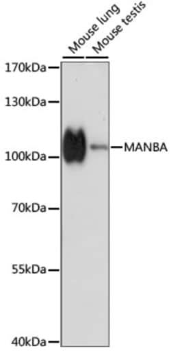ABclonal Technology&nbsp;MANBA Rabbit pAb