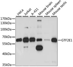 ABclonal Technology&nbsp;GTF2E1 Rabbit pAb