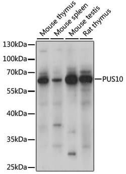 ABclonal Technology&nbsp;PUS10 Rabbit pAb