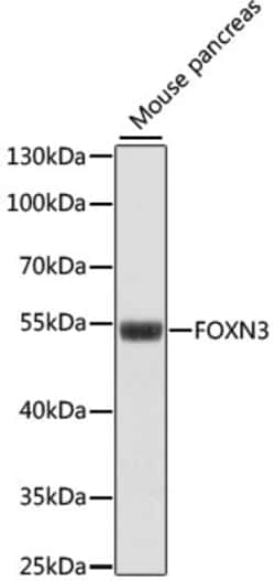 ABclonal Technology&nbsp;FOXN3 Rabbit pAb