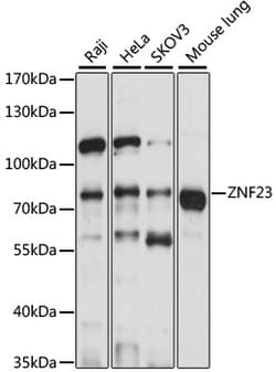 ABclonal Technology ZNF23 Rabbit pAb