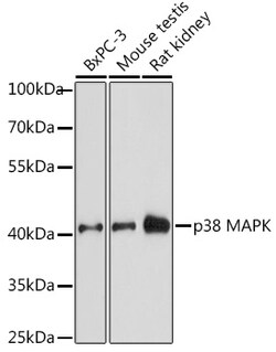 ABclonal Technology&nbsp;p38 MAPK Rabbit pAb