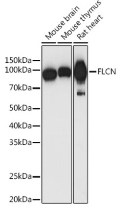 ABclonal Technology&nbsp;FLCN Rabbit pAb