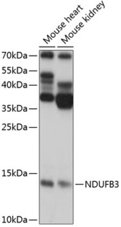 ABclonal Technology&nbsp;NDUFB3 Rabbit pAb