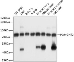 ABclonal Technology&nbsp;POMGNT2 Rabbit pAb