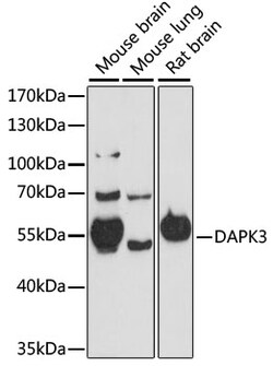 ABclonal Technology&nbsp;DAPK3 Rabbit pAb