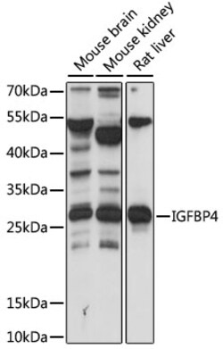 ABclonal Technology&nbsp;IGFBP4 Rabbit pAb