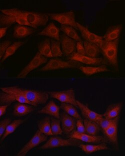 ABclonal Technology&nbsp;TGF beta 1 Rabbit pAb
