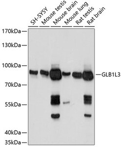 ABclonal Technology&nbsp;GLB1L3 Rabbit pAb
