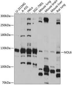 ABclonal Technology&nbsp;NOL6 Rabbit pAb