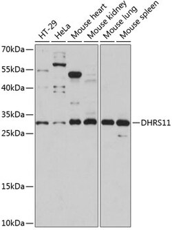 ABclonal Technology&nbsp;DHRS11 Rabbit pAb