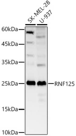 ABclonal Technology&nbsp;RNF125 Rabbit pAb