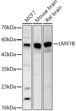 ABclonal Technology&nbsp;LMX1B Rabbit pAb