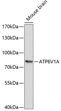 ABclonal Technology&nbsp;ATP6V1A Rabbit pAb