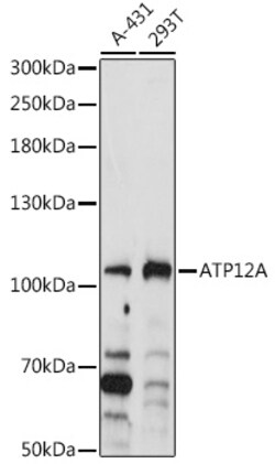ABclonal Technology&nbsp;ATP12A Rabbit pAb