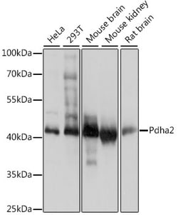 ABclonal Technology&nbsp;PDHA2 Rabbit pAb