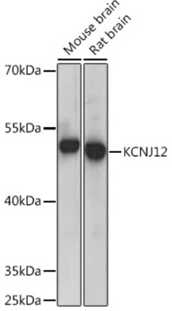 ABclonal Technology&nbsp;KCNJ12 Rabbit pAb