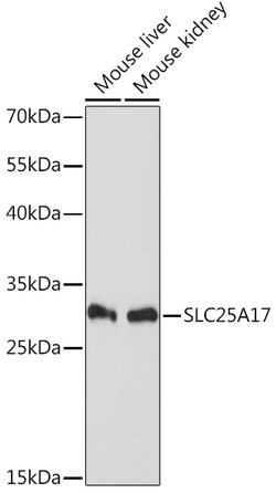 ABclonal Technology&nbsp;SLC25A17 Rabbit pAb