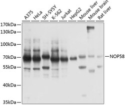 ABclonal Technology&nbsp;NOP58 Rabbit pAb