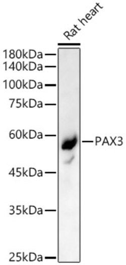 ABclonal Technology&nbsp;PAX3 Rabbit pAb