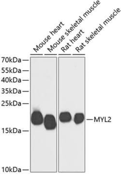 ABclonal Technology&nbsp;MYL2 Rabbit pAb