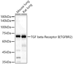 ABclonal Technology&nbsp;TGF beta Receptor II Rabbit pAb