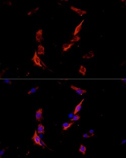 ABclonal Technology&nbsp;ErbB3/HER3 Rabbit pAb