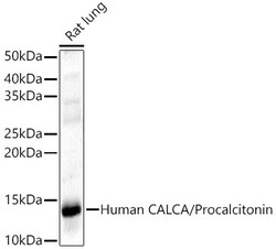 ABclonal Technology&nbsp;CALCA Rabbit pAb