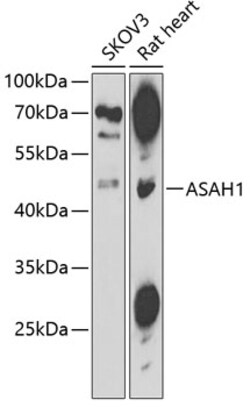 ABclonal Technology&nbsp;ASAH1 Rabbit pAb