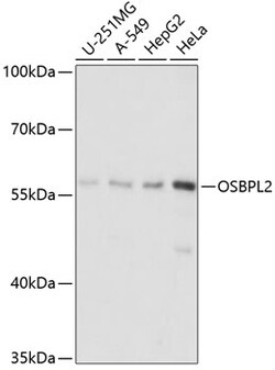 ABclonal Technology&nbsp;OSBPL2 Rabbit pAb