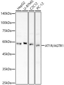 ABclonal Technology&nbsp;AT1R/AGTR1 Rabbit pAb
