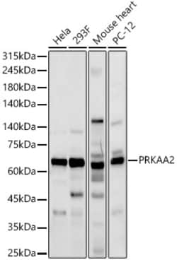 ABclonal Technology&nbsp;AMPKα2 Rabbit pAb