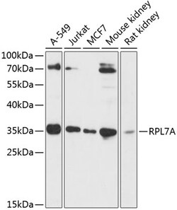 ABclonal Technology&nbsp;RPL7A Rabbit pAb