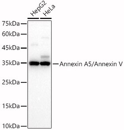 ABclonal Technology&nbsp;Annexin A5/Annexin V Rabbit pAb