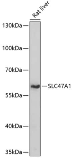 ABclonal Technology&nbsp;SLC47A1 Rabbit pAb