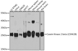 ABclonal Technology&nbsp;Casein Kinase 2 beta (CSNK2B) Rabbit pAb
