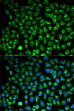 ABclonal Technology&nbsp;Monoamine Oxidase A (MAOA) Rabbit pAb