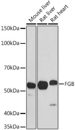 ABclonal Technology&nbsp;FGB Rabbit pAb